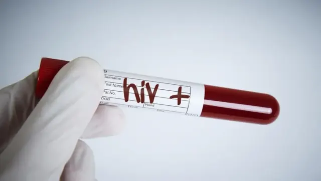 Jadwal Layanan Tes HIV & ARV Semarang 'Lidya Dimari' 6 September 2023 Malam