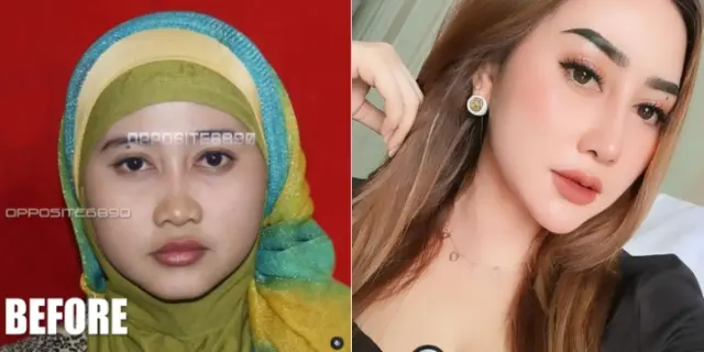 Viral Foto Jadul Luluk Nuril Sebelum Dipermak, Publik: Kirain Cantik dari Sananya, Ternyata dari Dananya