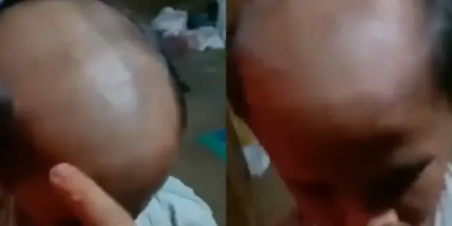 Terjadi Lagi! Guru Botaki Siswa SMP , Tega Sisakan Sedikit Rambut di Samping hingga Tampilannya Mirip Badut