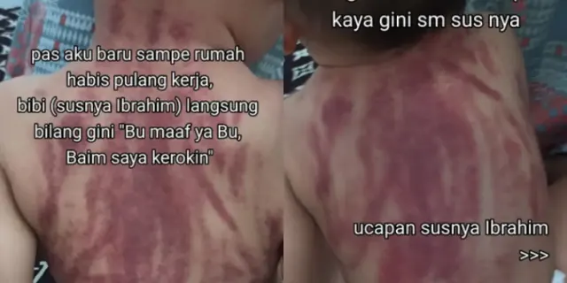 PARAH! Viral Bayi Dikerok Pengasuh Sampai Menangis Histeris, Bagian Punggung Memerah Bikin Publik Tak Tega