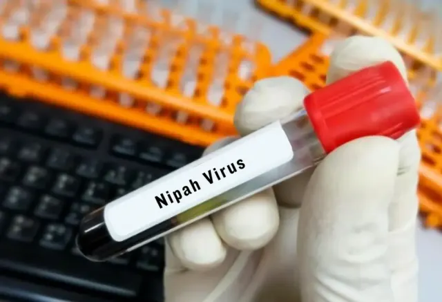 Cara Pemerintah India Cegah Penyebaran Virus Nipah, Seperti Apa Gejalanya?