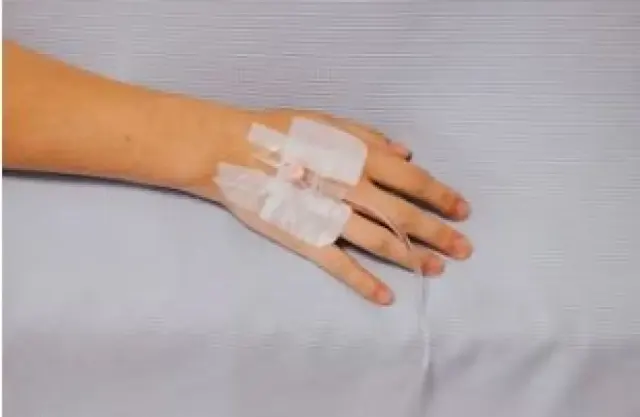 Diduga Jadi Korban Malparaktik Dokter di Bekasi, Anak 7 Tahun Meninggal Dunia